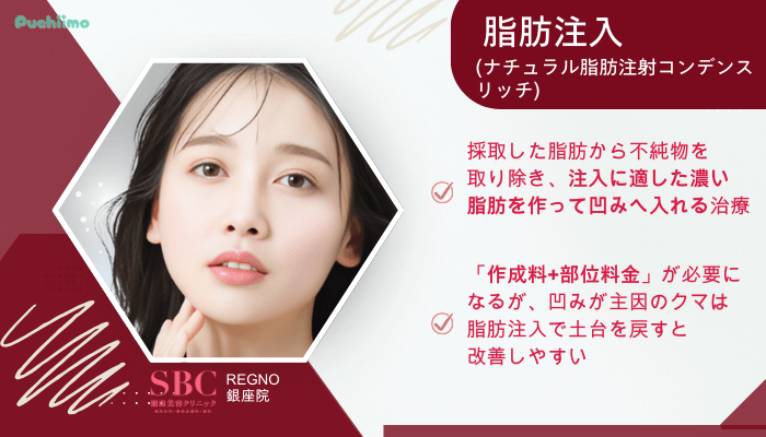 SBCRegno銀座クマ取り脂肪注入