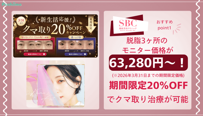 SBCクマ取りおすすめポイント1