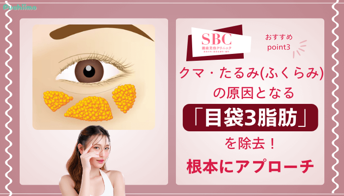 SBCクマ取りおすすめポイント3