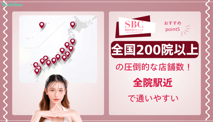 SBCクマ取りおすすめポイント5