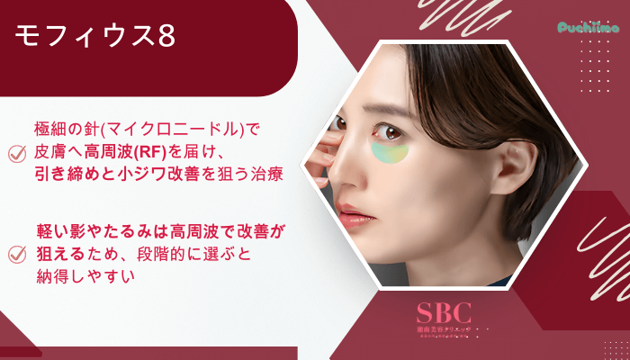 SBCクマ取りモフィウス8