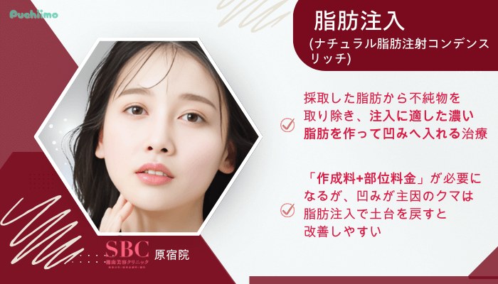 SBC原宿クマ取り脂肪注入