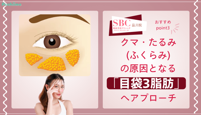 SBC品川クマ取りおすすめポイント3