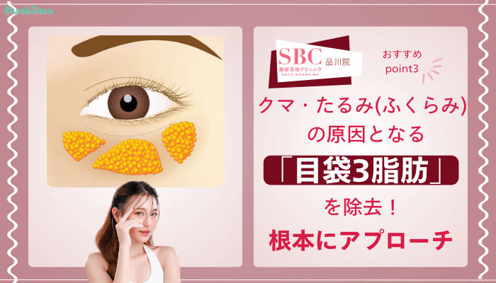 SBC品川クマ取りおすすめポイント3