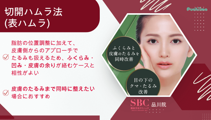 SBC品川クマ取り切開ハムラ法