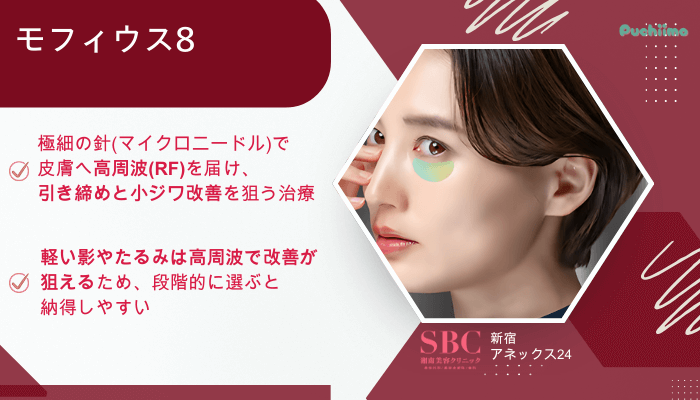 SBC新宿アネックス24クマ取りモフィウス8