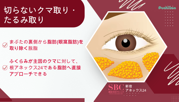 SBC新宿アネックス24クマ取り切らないクマ取り・たるみ取り