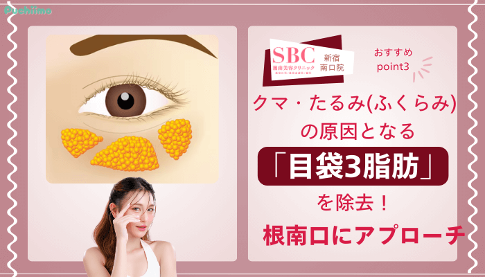 SBC新宿南口クマ取りおすすめポイント3