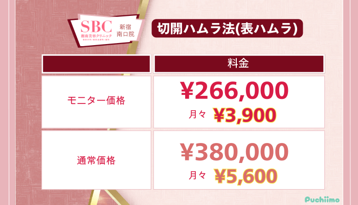 SBC新宿南口クマ取り切開ハムラ法の料金