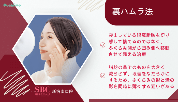 SBC新宿南口クマ取り裏ハムラ法