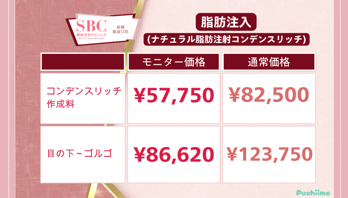 SBC新橋銀座口クマ取り脂肪注入の料金