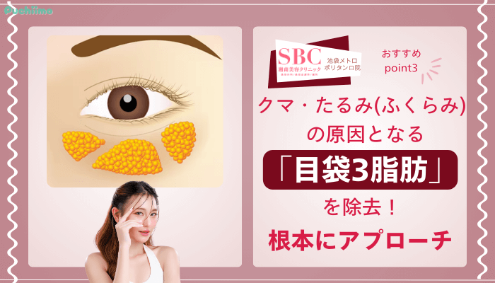 SBC池袋メトロポリタン口クマ取りおすすめポイント3