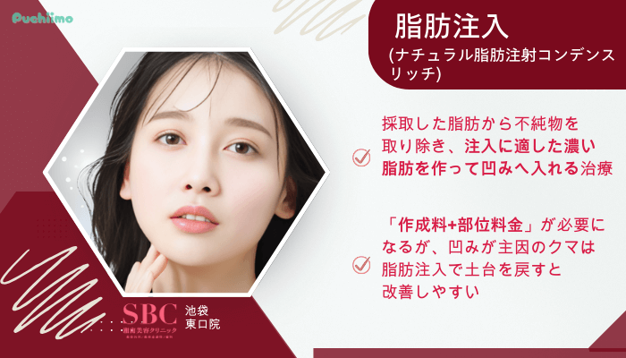 SBC池袋東口クマ取り脂肪注入