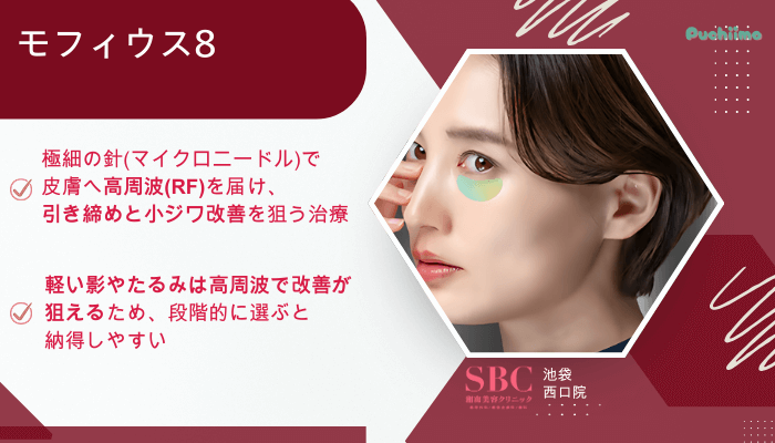 SBC池袋西口クマ取りモフィウス8