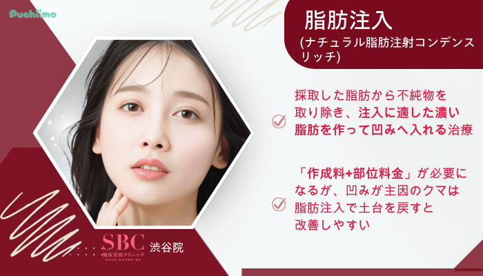 SBC渋谷クマ取り脂肪注入