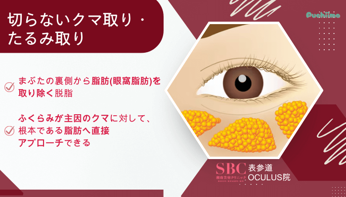 SBC表参道Oculusクマ取り切らないクマ取り・たるみ取り