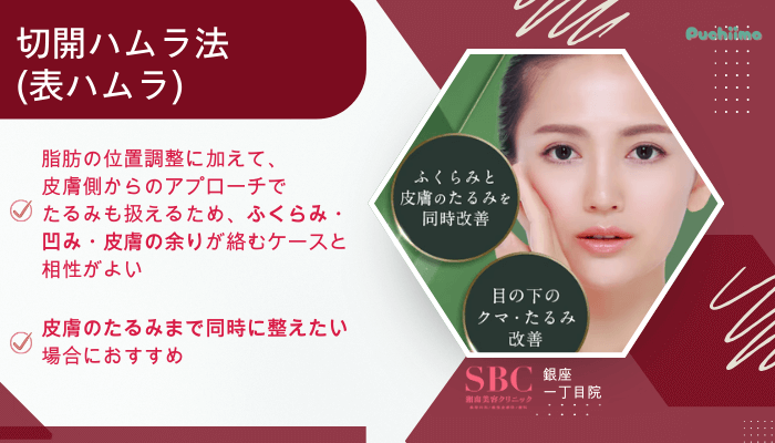 SBC銀座一丁目クマ取り切開ハムラ法