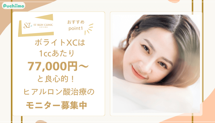STスキンクリニック青山ヒアルロン酸おすすめポイント1