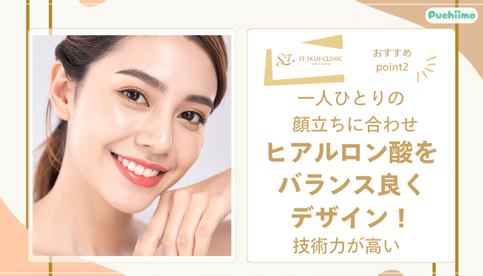 STスキンクリニック青山ヒアルロン酸おすすめポイント2