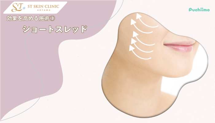 STスキンクリニック青山ヒアルロン酸効果を高める施術3