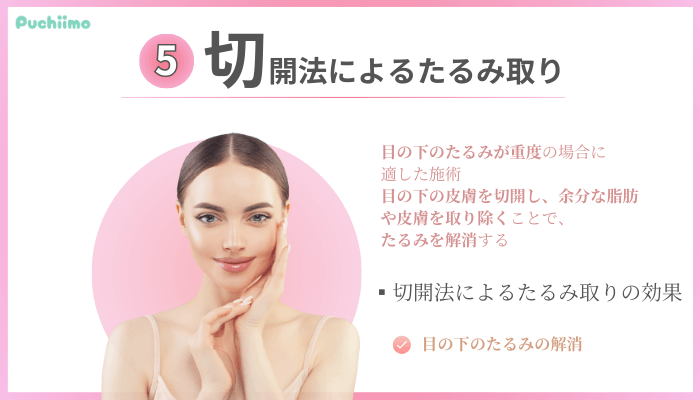 クマ取り大阪切開法によるたるみ取り