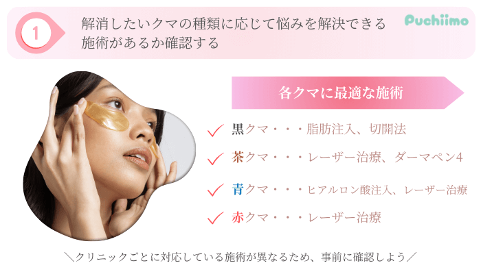 クマ取り選び方ポイント1大阪