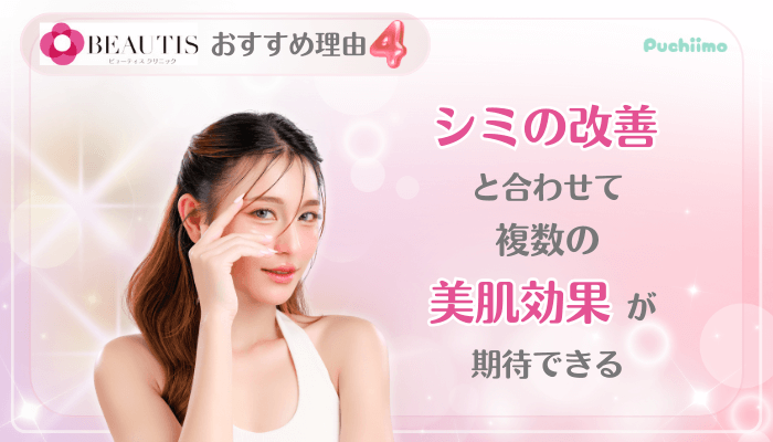 ビューティスクリニックシミ取り治療おすすめ理由4