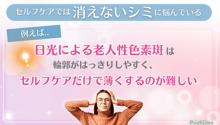 ビューティスクリニックシミ取り治療を検討している方が抱えやすい悩み・不安1