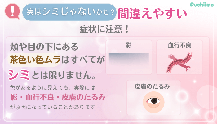 ビューティスクリニックシミ取り治療シミじゃないかも