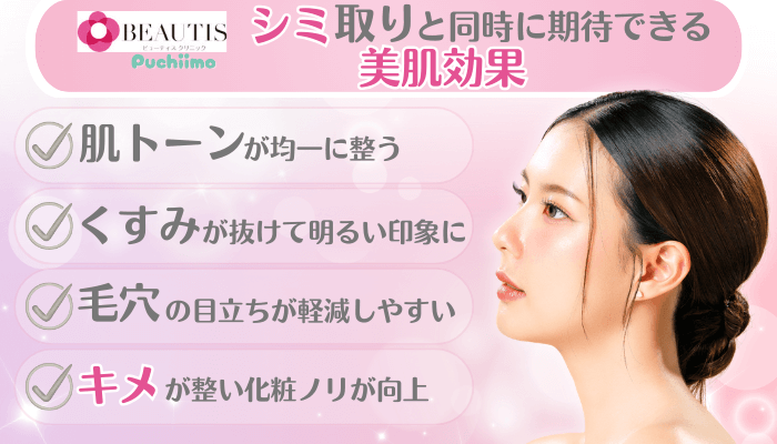 ビューティスクリニックシミ取り治療同時に期待できる美肌効果