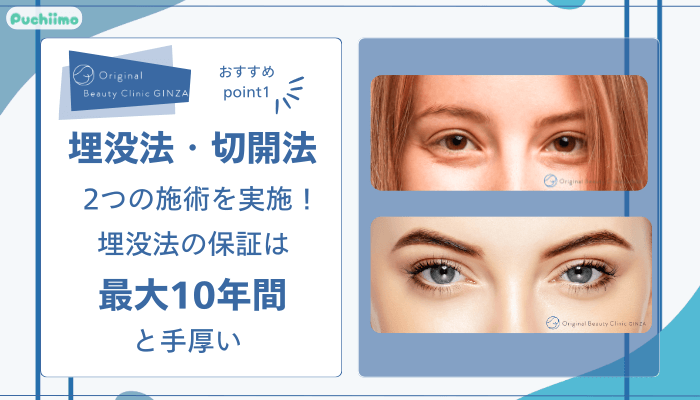 Original-Beauty-Clinic-GINZA二重整形おすすめポイント1