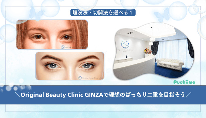 Original-Beauty-Clinic-GINZA二重整形まとめ