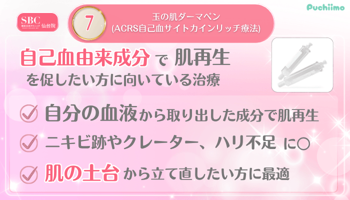 SBC仙台美肌治療メイン施術7