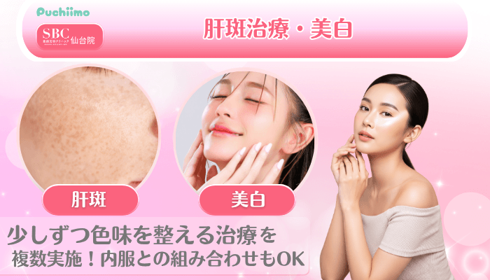 SBC仙台美肌治療肝斑治療・美白