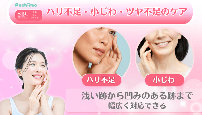 SBC千葉センシティ美肌治療ハリ不足・小じわ・ツヤ不足のケア