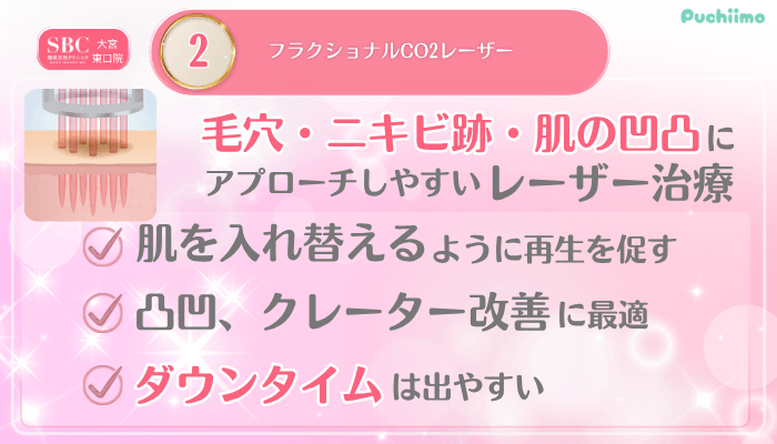 SBC大宮東口美肌治療メイン施術2