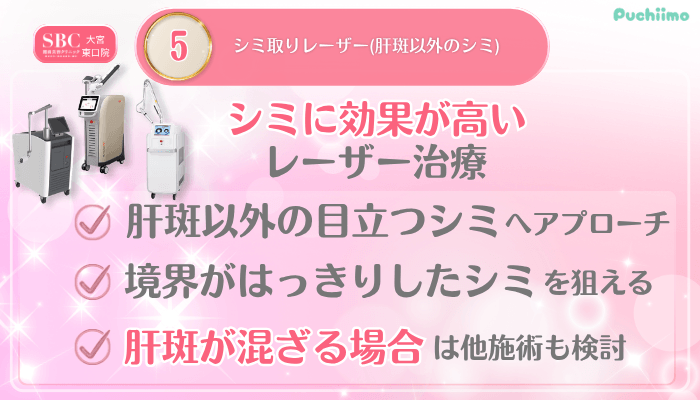 SBC大宮東口美肌治療メイン施術5