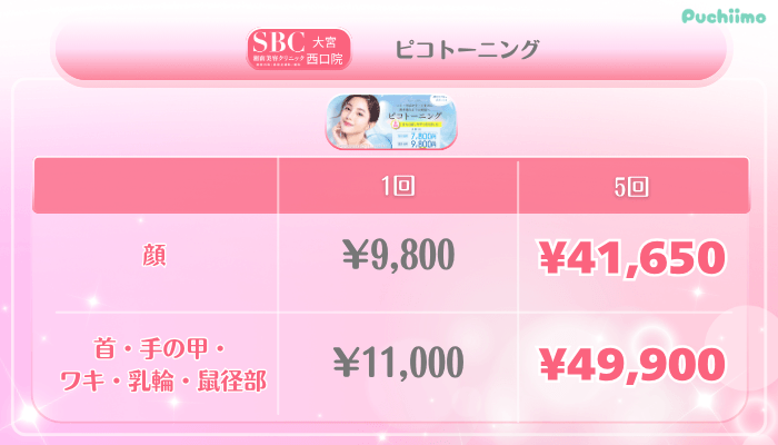 SBC大宮西口美肌治療ピコトーニング料金
