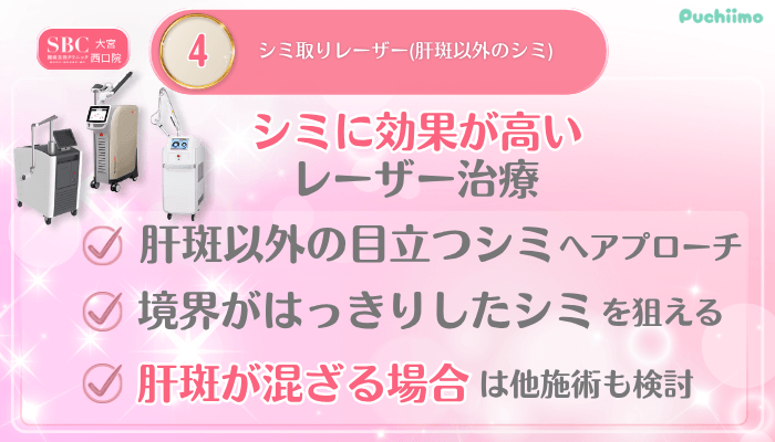 SBC大宮西口美肌治療メイン施術4