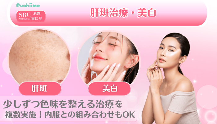 SBC池袋東口美肌治療肝斑治療・美白
