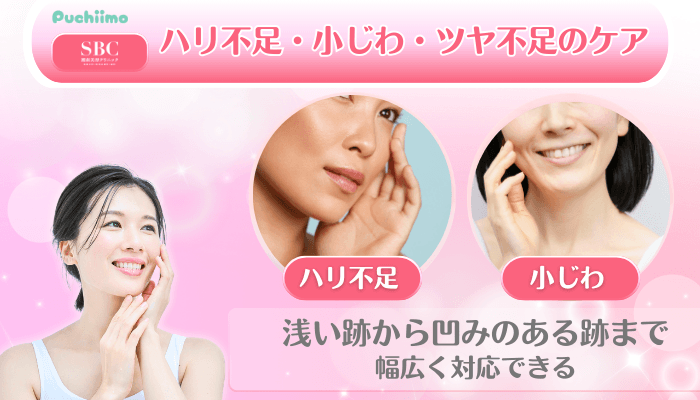 SBC美肌治療ハリ不足・小じわ・ツヤ不足のケア