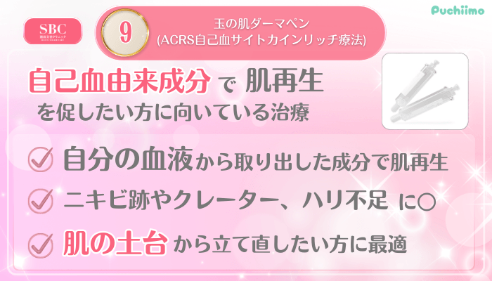 SBC美肌治療メイン施術9