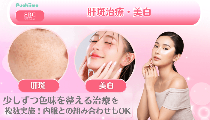 SBC美肌治療肝斑治療・美白