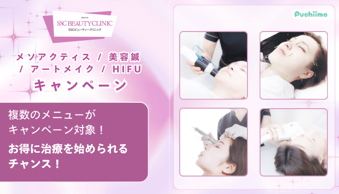 SSCビューティークリニックメソアクティス-_-美容鍼-_-アートメイク-_-HIFUキャンペーン