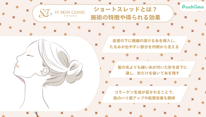 STスキンクリニック青山糸リフトとは