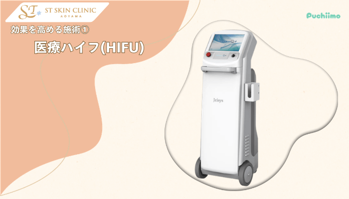 STスキンクリニック青山糸リフト効果を高める施術1