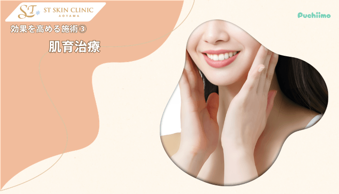 STスキンクリニック青山糸リフト効果を高める施術3