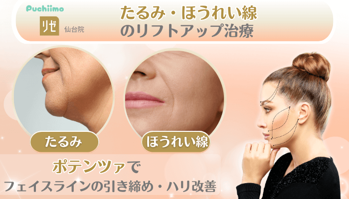 リゼクリニック仙台美肌治療たるみ・ほうれい線のリフトアップ治療