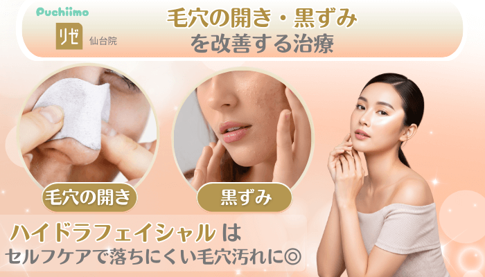 リゼクリニック仙台美肌治療毛穴の開き・黒ずみを改善する治療