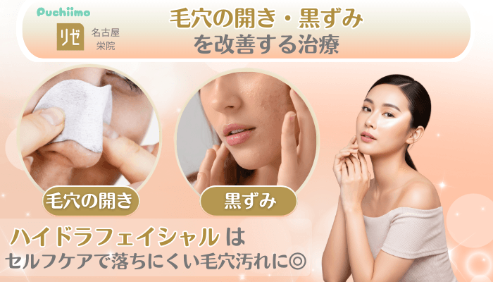 リゼクリニック名古屋栄美肌治療毛穴の開き・黒ずみを改善する治療